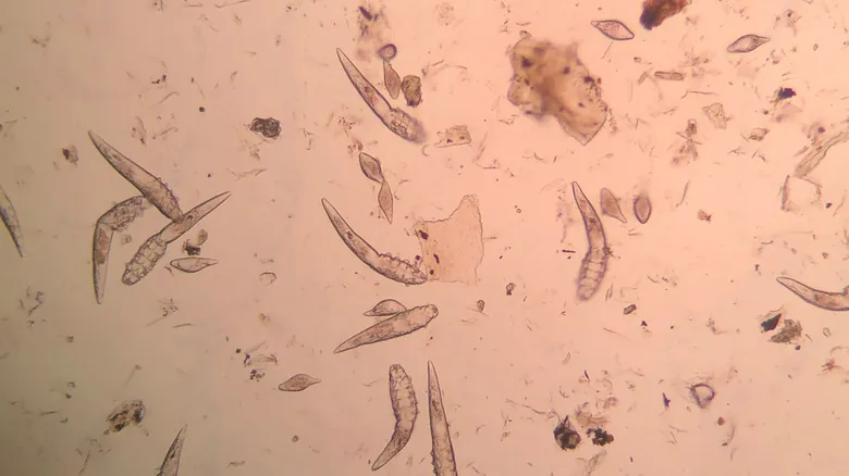 Ácaros Demodex: La Vida Microscópica Oculta en Tu Piel y Sus Secretos