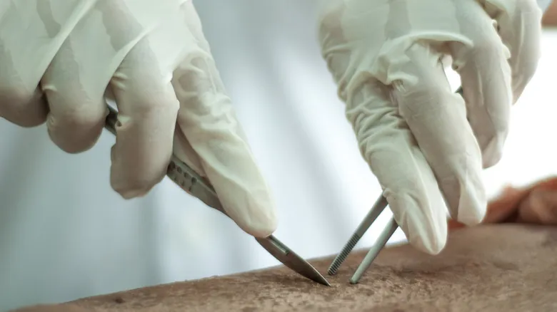 Donar el Cuerpo a la Ciencia: Un Legado Altruista para la Medicina y el Futuro