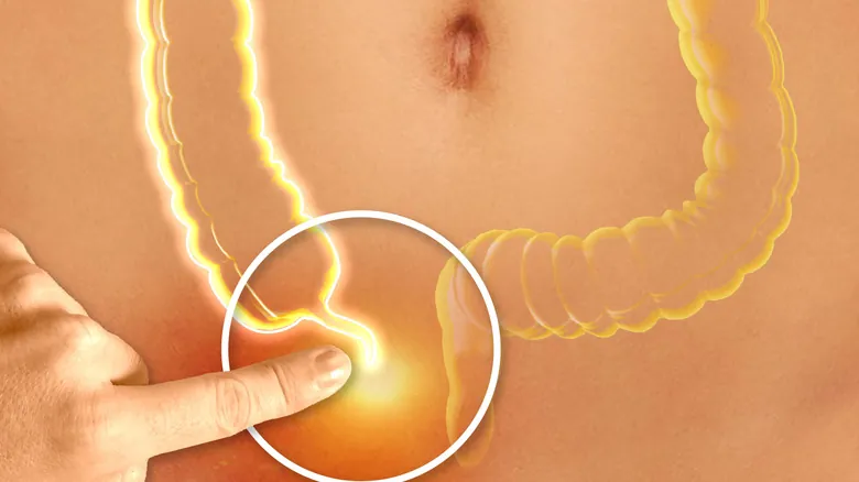 El Apéndice: Desvelando Sus Funciones Vitales Más Allá de un Órgano 'Vestigial'