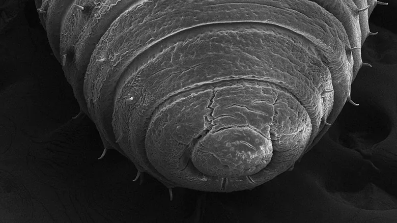La Realidad Microscópica: ¿Qué Revelan las Lombrices de Tierra Bajo el Microscopio?