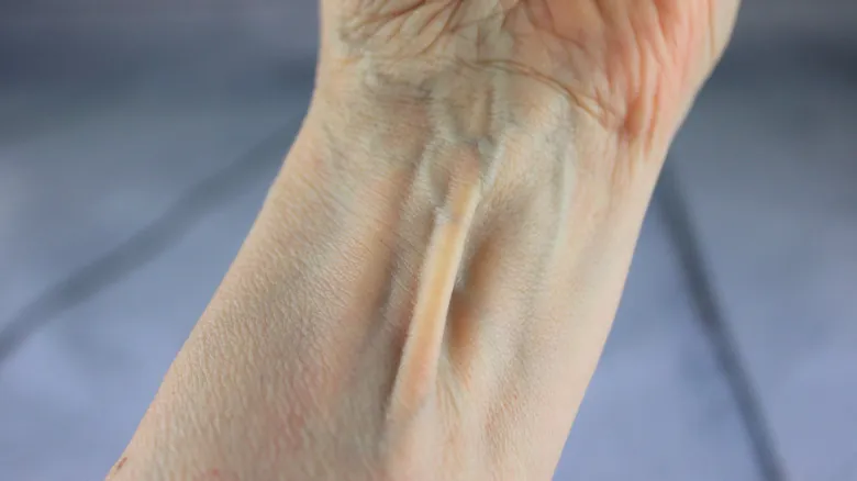 Rasgos Vestigiales: El Palmaris Longus y Otras Evidencias de la Evolución Humana