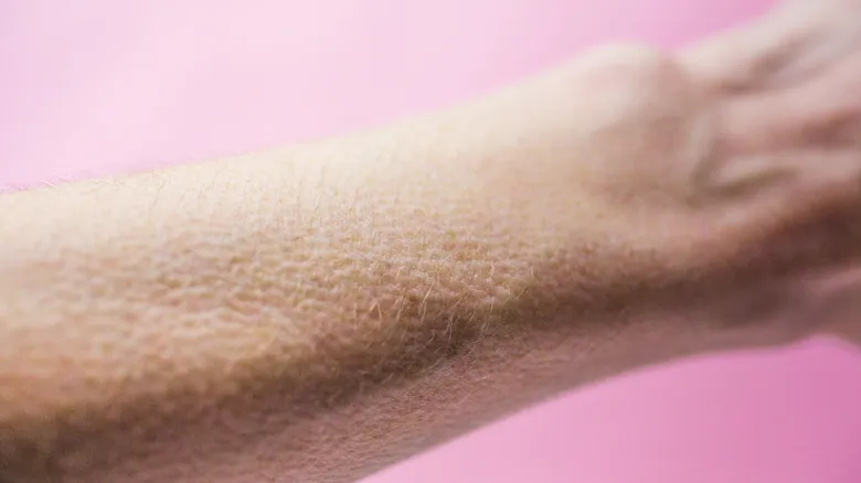 Rasgos Vestigiales: El Palmaris Longus y Otras Evidencias de la Evolución Humana